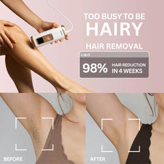 Lumluna IPL Hair Removal Handset 2.0