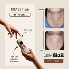 Lumluna IPL Hair Removal Handset 2.0